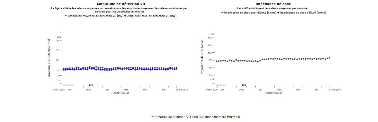 Tls telecardio amplitude